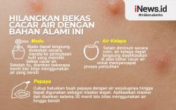 Infografis Cara Menghilangkan Bekas Cacar Air