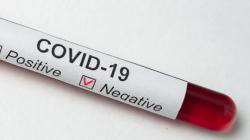 Libur Nataru Usai, Kasus Covid-19 di Cimahi Tak Melonjak, Ngatiyana Lega<