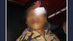 Ngeri, Busur Panah Tertancap di Mata Kiri Remaja di Makassar