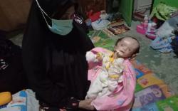 Nestapa Bayi Fauzian Idap Hidrosefalus dan Tangan Kiri Lumpuh 