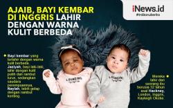 Bayi Kembar Lahir dengan Warna Kulit Berbeda