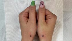 Tak Bisa Bedakan Kanan dan Kiri, Perempuan Ini Bikin Tato R dan L di Tangan