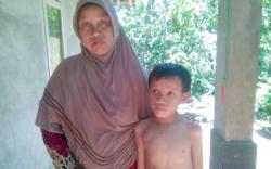 Miris, Anak Usia 11 Tahun di Pangandaran Hidup dengan Bocor Jantung