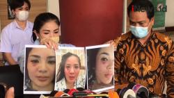 Pergoki Suami Selingkuh, Nindy Ayunda Dipukul