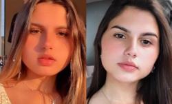 Pertama di Dunia, Kembar Identik Jalani Operasi Ganti Kelamin Bersamaan