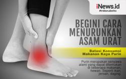 Infografis Usir Asam Urat dengan Cara Ini