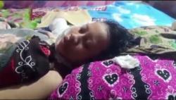 Sadis, Siswi SMK di Brebes Disiram Cairan Misterius hingga Terluka Bakar 