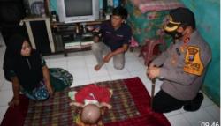 Kapolres Batubara Jenguk Bayi Hidrosefalus: Tidak Ada yang Mustahil bagi Tuhan