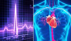 Waspada! Denyut Jantung Terlalu Lambat Bisa Sebabkan Stroke   