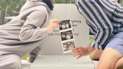 Felicya Angelista Umumkan Hamil Anak Pertama, Akun Instagramnya Banjir Ucapan Selamat 