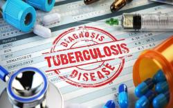 Kasus TBC di Gunungkidul Tinggi, Selama 2022 Ada 311 Penderita