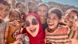 Ria Ricis Posting Foto Terbaru, Netizen: Dagunya Oplas 