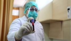 Ini Gejala Anemia Secara Kasat Mata Terkadang Disepelekan