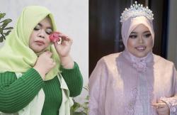 Intip Transformasi Kekeyi sebelum dan sesudah Filler Hidung, Netizen: Makin Cantik!