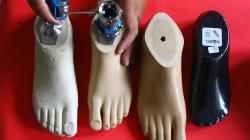 Perajin Kaki Palsu Kekurangan Tenaga Kerja Terampil