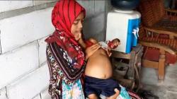 Kasihan, Balita dari Keluarga Miskin di Bojonegoro Idap Kanker Ginjal 