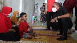 Edy Rahmayadi Temui Kakak Adik di Medan Idap Penyakit Kulit Aneh di Sekujur Tubuh<