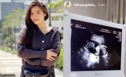 Hamil 5 Bulan, Felicya Angelista Masuk Rumah Sakit dan Jalani Tindakan