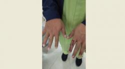 Jadi Korban Amukan Keluarga Pasien Covid-19, Perawat RSUD Ambarawa Lapor Polisi 