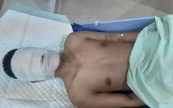 Aktor Intelektual Penyiraman Air Keras ke Wajah Wartawan Ditangkap Polrestabes Medan