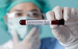 Kasus Covid-19 di Sumsel Kembali Meningkat, Bertambah 724 pada 3 Agustus<