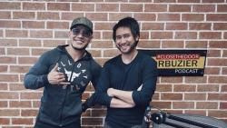 Cerita Kevin Aprilio Jalani Transplantasi Rambut di Turki, 12 Jam Rela Ditusuk 18.000 Kali