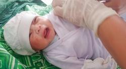 Ibu Hamil Tewas Digigit Ular Kobra, Bayinya Diselamatkan lewat Operasi Caesar<