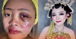 Viral MUA Rias Wajah Calon Pengantin Perempuan dari Penuh Luka Jadi Mulus Cantik 