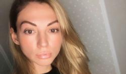 Tragis, Influencer Cantik Ini Meninggal saat Operasi Plastik Ubah Bentuk Hidung