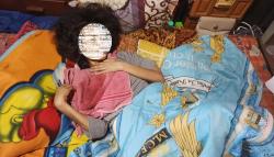 Perempuan di Sukabumi Pasrah Idap Kanker Payudara, 6 Bulan Kesehatan Memburuk<