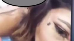 Calon Bintang Porno Tewas Gegara 3 Kali Disuntik Silikon Cair di Bokong