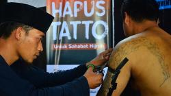 Melihat Pelayanan Hapus Tato Gratis