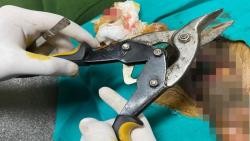 Duh, Penis Pria dengan Gangguan Jiwa Tercekik Botol selama 2 Bulan