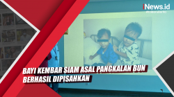 Video Bayi Kembar Siam asal Pangkalan Bun Berhasil Dipisahkan