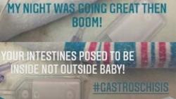 Komentari Bayi Cacat di Facebook, Perawat Dipecat