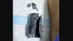 Duh, Alat Vital Pria Ini Nyangkut di Pipa Plastik