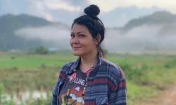 Idap Tumor di Perut, Ternyata Melanie Subono Alami Pendarahan Puluhan Tahun 