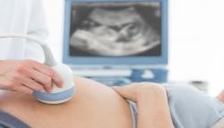  7 Rekomendasi Tempat USG Terdekat di Bandung Jawa Barat