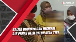 Tragis, Balita Dianiaya dan Disiram Air Panas oleh Calon Ayah Tiri di Kota Batu