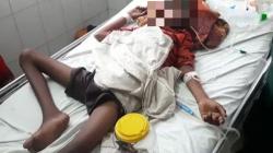 Nekat Makan 16 Sikat Gigi dan Paku, Bocah Ini Dianggap Kerasukan Hantu