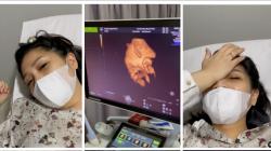 Anak dalam Kandungan Nagita Slavina Ngumpet saat USG, Raffi Ahmad: Si Bayi Ngambek