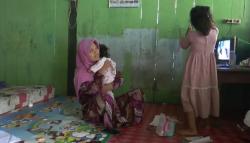 Balita di Grobogan Ini Derita Penyakit Langka, Kulit Tubuh Melepuh dan Mudah Terkelupas<