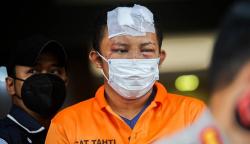 Begini Wajah Lebam Perampok usai Tepergok Beraksi di Toko Gadai Jagakarsa 