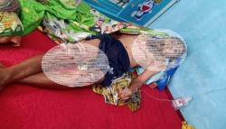 Ini Kronologi Tubuh Pedagang Masuk Penggorengan, Epilepsi Korban Kambuh<