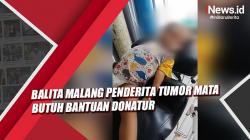 Balita Malang Penderita Tumor Mata di Lampung Butuh Bantuan Donatur