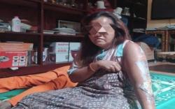 Tragis, Perempuan Ini Dibakar Suami usai Sholat Gegara Cemburu Buta