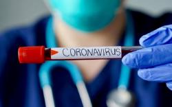 Satgas Covid-19 Pastikan Varian Omicron Belum Terdeteksi Masuk Wilayah DIY 