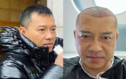  Anang Hermansyah Transplantasi Rambut, Netizen Sebut Malah Mirip Raul Lemos<