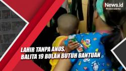 Lahir Tanpa Anus, Balita 19 Bulan Butuh Bantuan di Purworejo