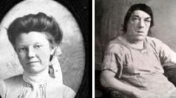 Kisah Mary Ann Bevan, Perawat yang Ikuti Kontes Wanita Terjelek di Dunia Bikin Haru